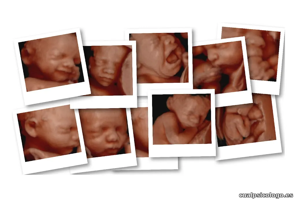 Ecox Igualada, Barcelona | Especialistas en ecografías 5D, 4D y 8K